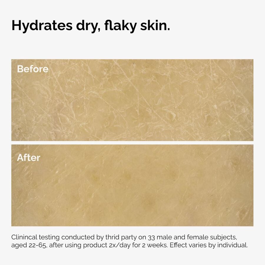 the-body-care-collection-i2 ord-natural-moisturizing-factors-inulin-body-before-after-graphic-02.jpg