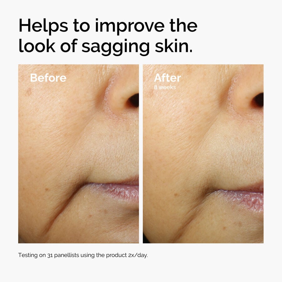 caffeine-3-escin-1-face-serum-r7 ord-caffeine-3pct-escin-1pct-face-serum-before-after-sagging.jpg