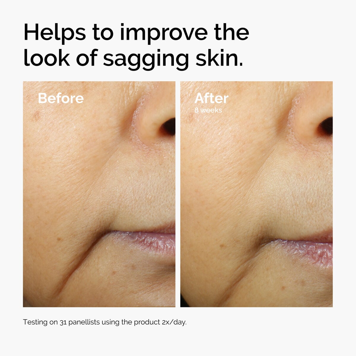caffeine-3-escin-1-face-serum-r7 ord-caffeine-3pct-escin-1pct-face-serum-before-after-sagging.jpg
