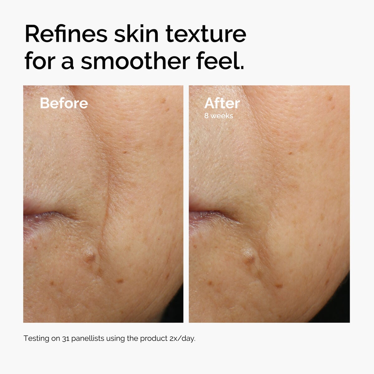 caffeine-3-escin-1-face-serum-r7 ord-caffeine-3pct-escin-1pct-face-serum-before-after-texture.jpg