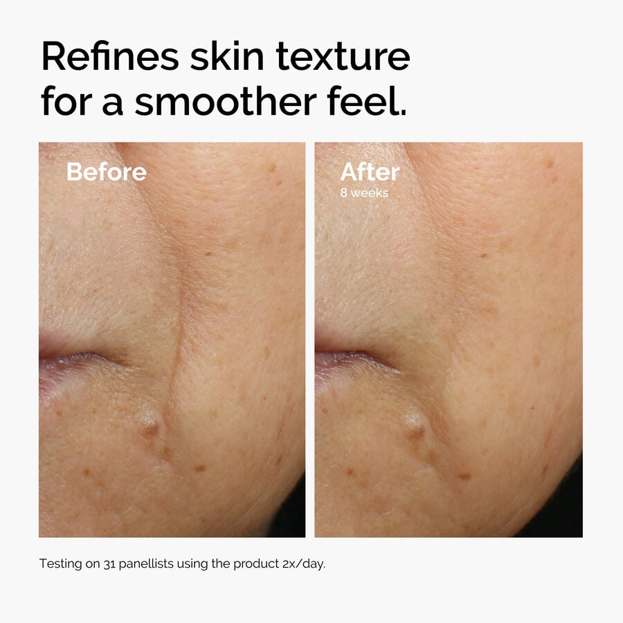 caffeine-3-escin-1-face-serum-r7 ord-caffeine-3pct-escin-1pct-face-serum-before-after-texture.jpg