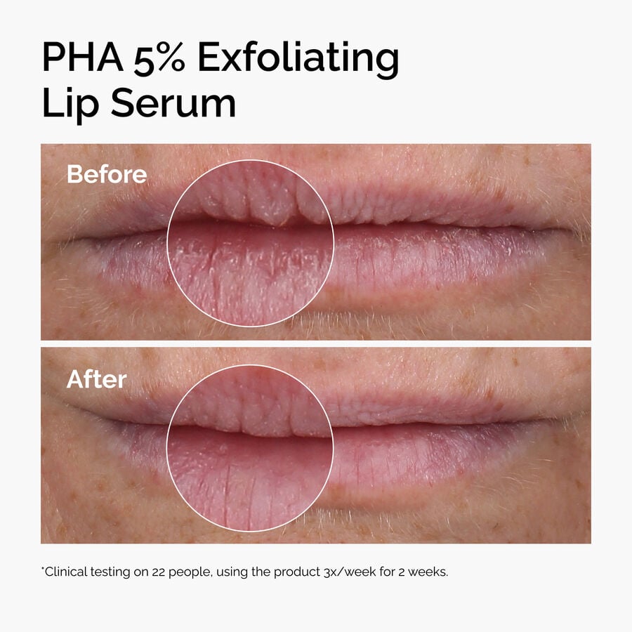 pha-5-exfoliating-lip-serum-i3 ord-pha-5pct-lip-exfoliating-serum-before-after.jpg