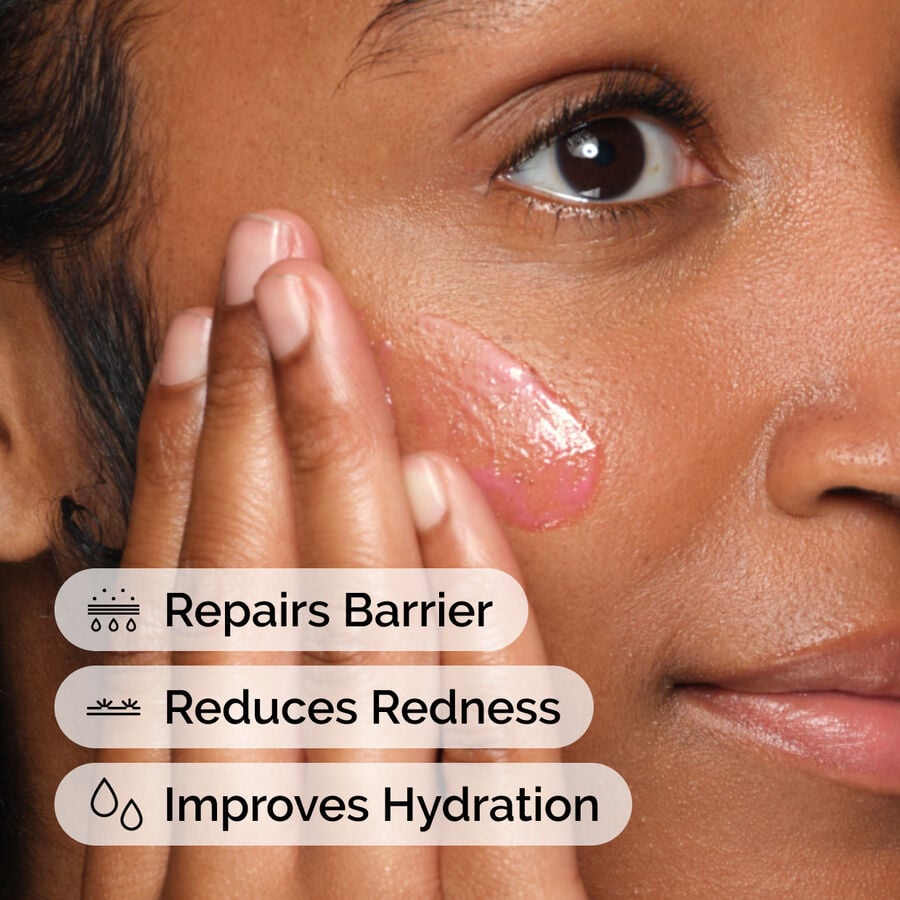 soothing-and-barrier-support-serum-m9 ord-soothing-barrier-support-serum-model-application-with-benefits.jpg